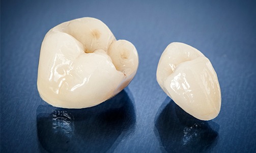 Two dental crown restorations prior to placement