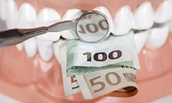 Money in a set of teeth