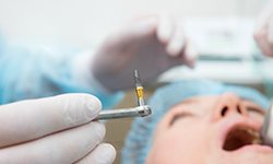 dental implant surgery in Idaho Falls