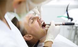 Man getting dental work during sedation dentistry in Idaho Falls