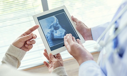 X-rays of skull and jawbones