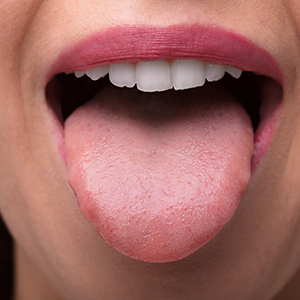 What Your Tongue Says About Your Health - Oxford Dental Care Blog